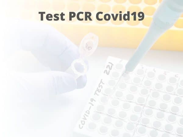 Test Covid19 Parejo y Cañero