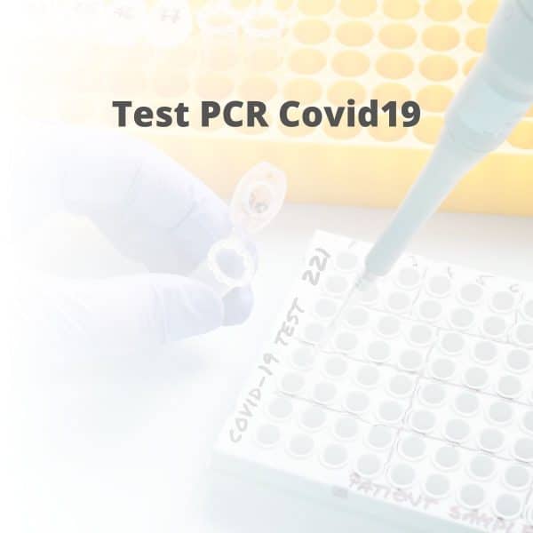 Test Covid19 Parejo y Cañero