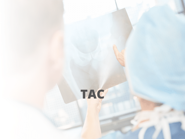 TAC